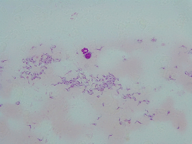 Trypanosoma Slides - Trypanosoma 02 100X